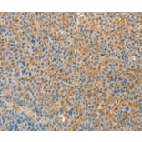 Immunohistochemistry - VTCN1 Antibody from Signalway Antibody (36273) - Antibodies.com