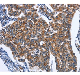 Immunohistochemistry - CADM3 Antibody from Signalway Antibody (36298) - Antibodies.com