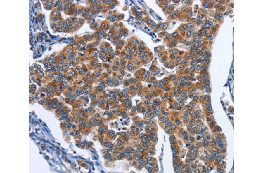 Immunohistochemistry - CADM3 Antibody from Signalway Antibody (36298) - Antibodies.com