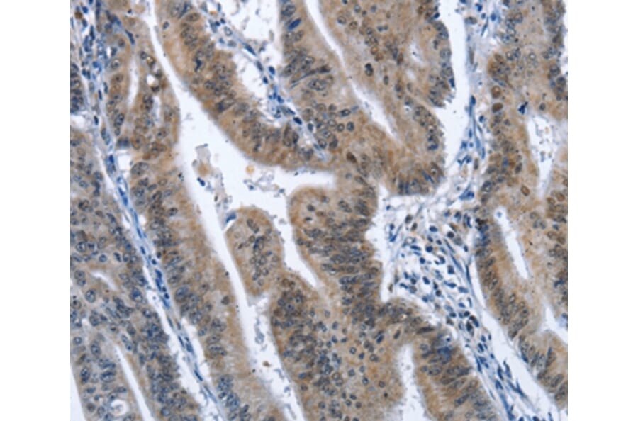 Immunohistochemistry - CADM3 Antibody from Signalway Antibody (36298) - Antibodies.com
