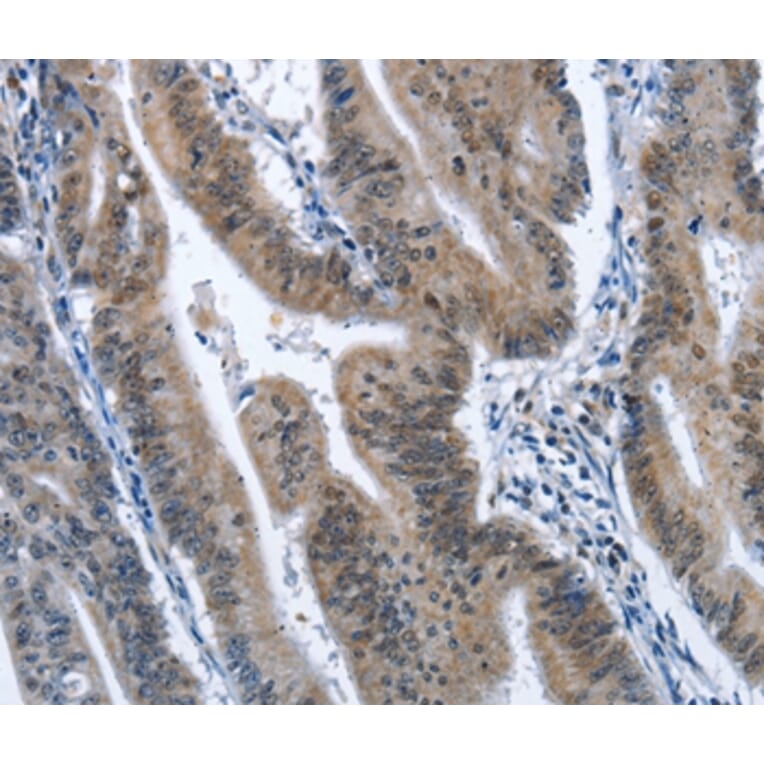 Immunohistochemistry - CADM3 Antibody from Signalway Antibody (36298) - Antibodies.com