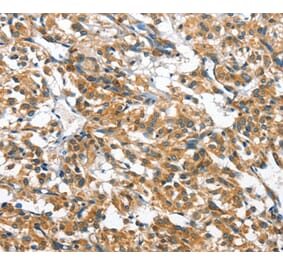 Immunohistochemistry - CASQ2 Antibody from Signalway Antibody (36301) - Antibodies.com