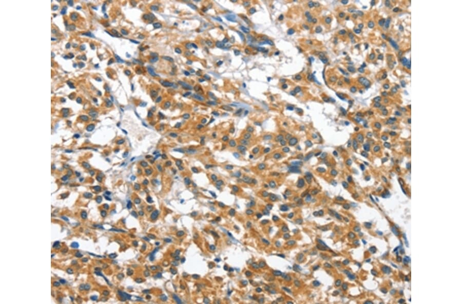 Immunohistochemistry - CASQ2 Antibody from Signalway Antibody (36301) - Antibodies.com