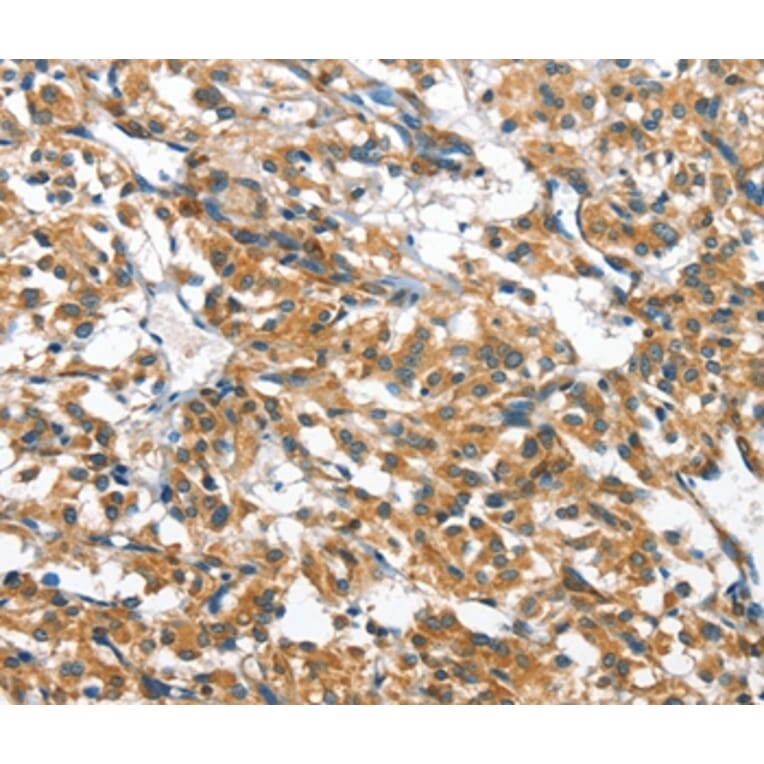 Immunohistochemistry - CASQ2 Antibody from Signalway Antibody (36301) - Antibodies.com