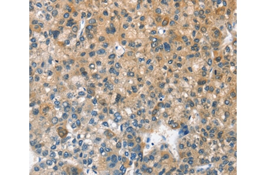 Immunohistochemistry - CASQ2 Antibody from Signalway Antibody (36301) - Antibodies.com