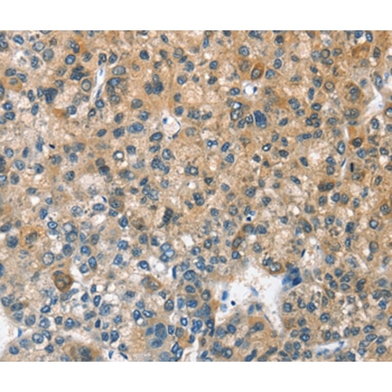 Immunohistochemistry - CASQ2 Antibody from Signalway Antibody (36301) - Antibodies.com