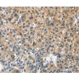 Immunohistochemistry - CASQ2 Antibody from Signalway Antibody (36301) - Antibodies.com