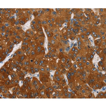 Immunohistochemistry - CARD9 Antibody from Signalway Antibody (36309) - Antibodies.com