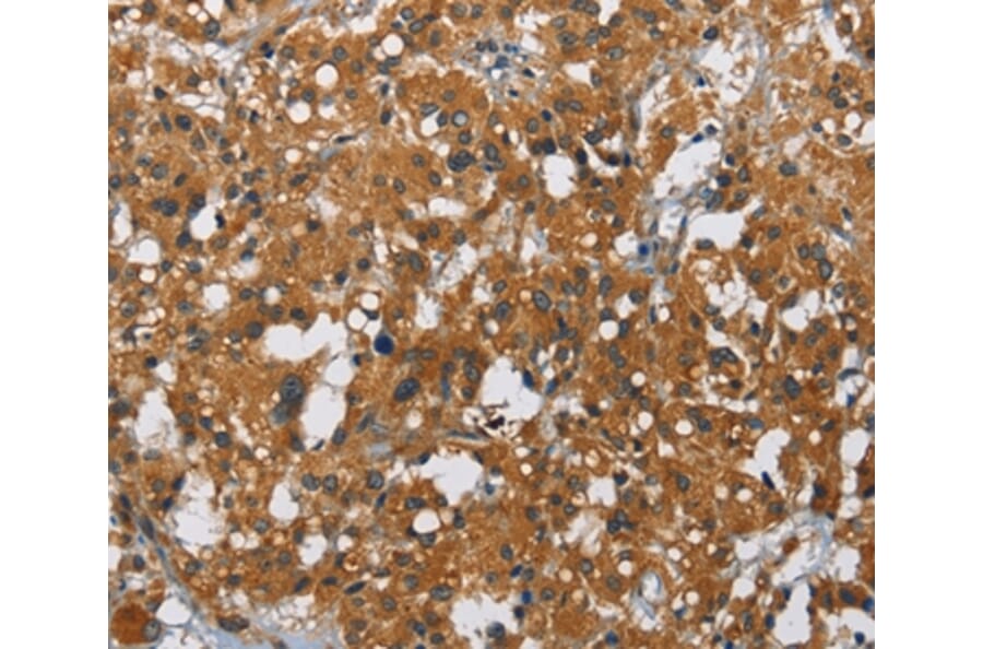 Immunohistochemistry - CARD9 Antibody from Signalway Antibody (36309) - Antibodies.com