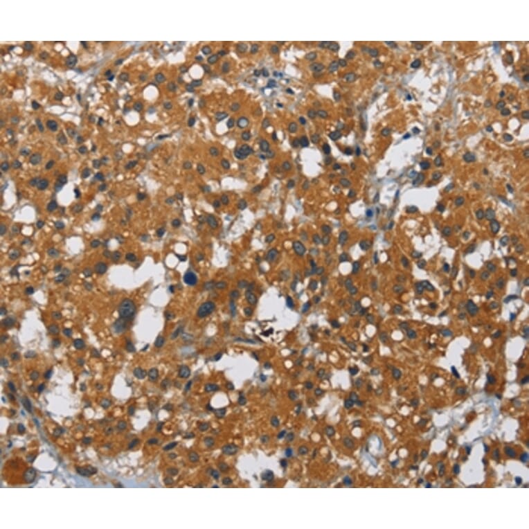 Immunohistochemistry - CARD9 Antibody from Signalway Antibody (36309) - Antibodies.com