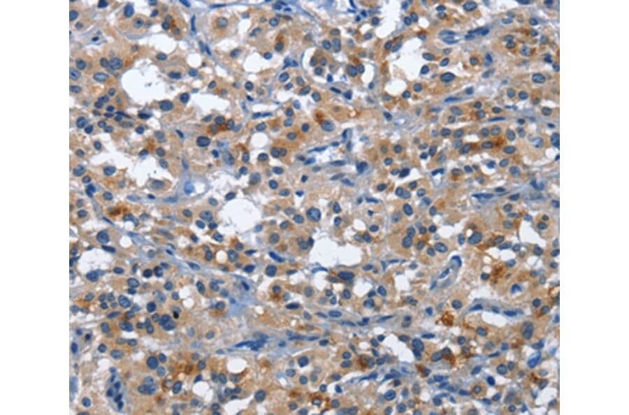 Immunohistochemistry - CD177 Antibody from Signalway Antibody (36325) - Antibodies.com