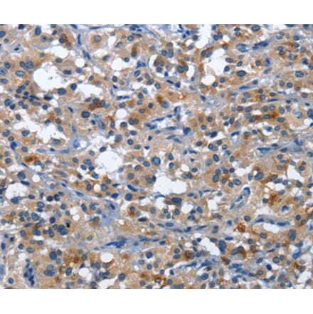 Immunohistochemistry - CD177 Antibody from Signalway Antibody (36325) - Antibodies.com