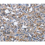 Immunohistochemistry - CD177 Antibody from Signalway Antibody (36325) - Antibodies.com