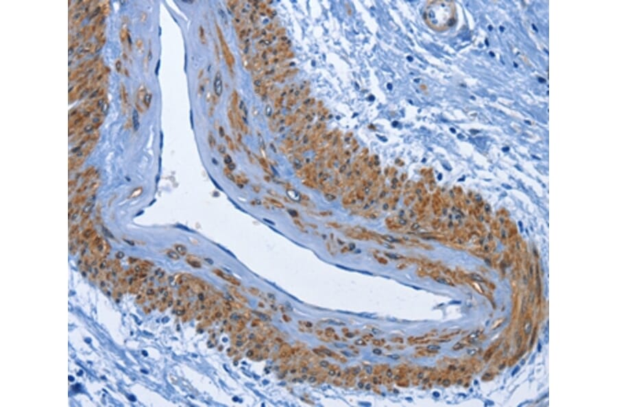 Immunohistochemistry - CD177 Antibody from Signalway Antibody (36325) - Antibodies.com