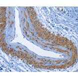 Immunohistochemistry - CD177 Antibody from Signalway Antibody (36325) - Antibodies.com
