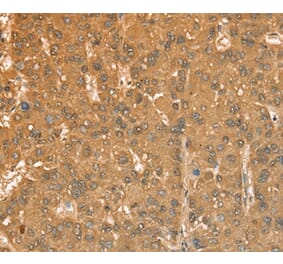Immunohistochemistry - CXCR4 Antibody from Signalway Antibody (36326) - Antibodies.com