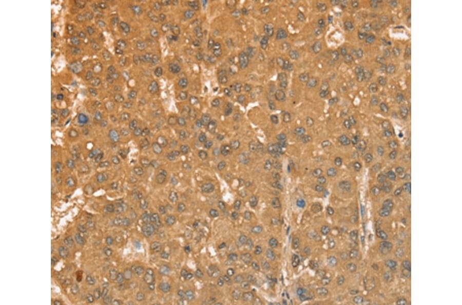 Immunohistochemistry - CXCR4 Antibody from Signalway Antibody (36326) - Antibodies.com