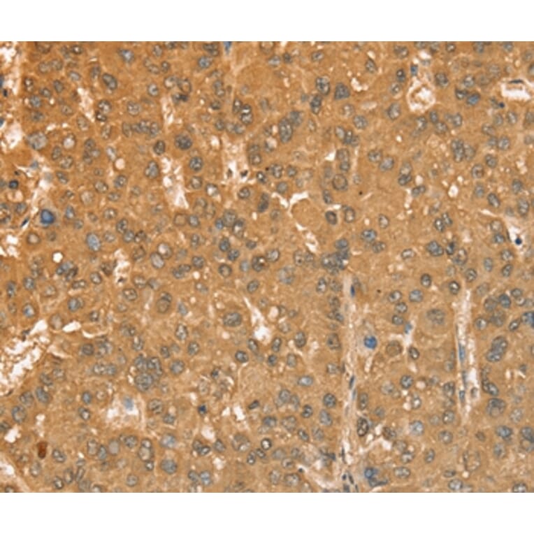 Immunohistochemistry - CXCR4 Antibody from Signalway Antibody (36326) - Antibodies.com