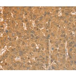 Immunohistochemistry - CXCR4 Antibody from Signalway Antibody (36326) - Antibodies.com