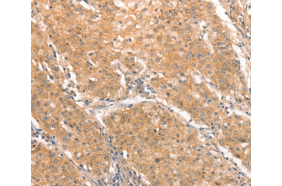 Immunohistochemistry - CXCR4 Antibody from Signalway Antibody (36326) - Antibodies.com