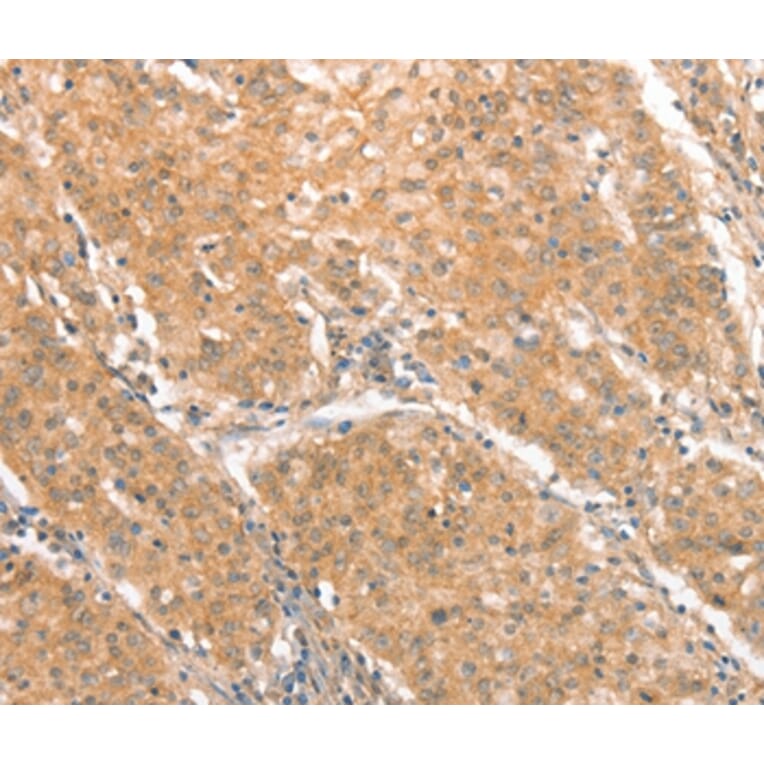 Immunohistochemistry - CXCR4 Antibody from Signalway Antibody (36326) - Antibodies.com
