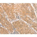 Immunohistochemistry - CXCR4 Antibody from Signalway Antibody (36326) - Antibodies.com