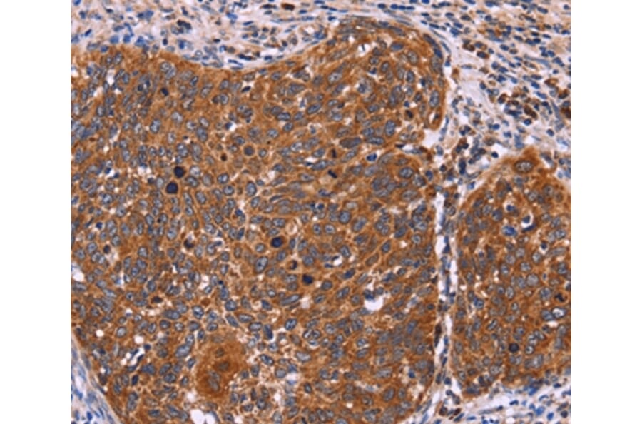 Immunohistochemistry - FBXW7 Antibody from Signalway Antibody (36334) - Antibodies.com