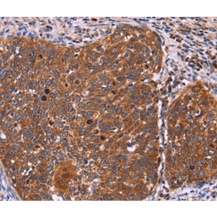 Immunohistochemistry - FBXW7 Antibody from Signalway Antibody (36334) - Antibodies.com