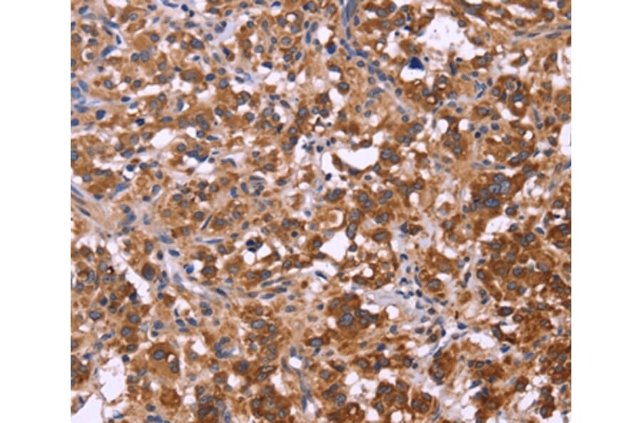 Immunohistochemistry - FBXW7 Antibody from Signalway Antibody (36334) - Antibodies.com