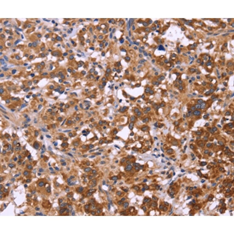 Immunohistochemistry - FBXW7 Antibody from Signalway Antibody (36334) - Antibodies.com