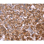 Immunohistochemistry - FBXW7 Antibody from Signalway Antibody (36334) - Antibodies.com