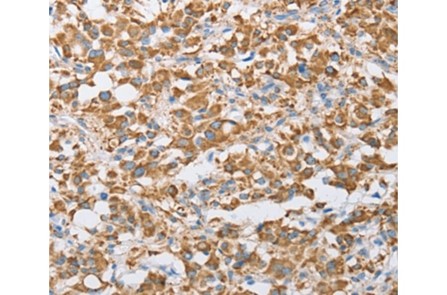 Immunohistochemistry - CENPO Antibody from Signalway Antibody (36341) - Antibodies.com