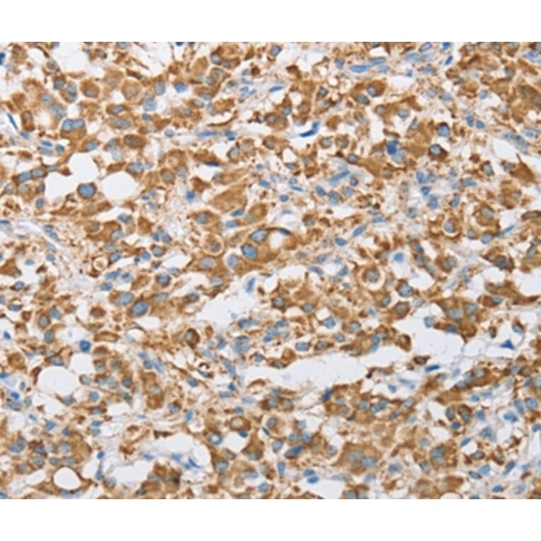 Immunohistochemistry - CENPO Antibody from Signalway Antibody (36341) - Antibodies.com