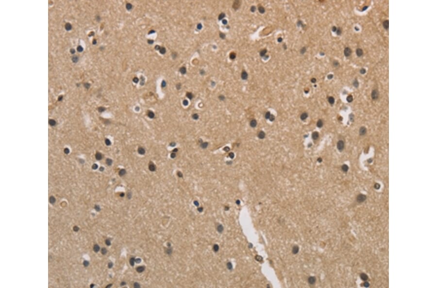 Immunohistochemistry - CENPN Antibody from Signalway Antibody (36342) - Antibodies.com
