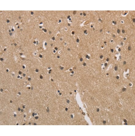 Immunohistochemistry - CENPN Antibody from Signalway Antibody (36342) - Antibodies.com