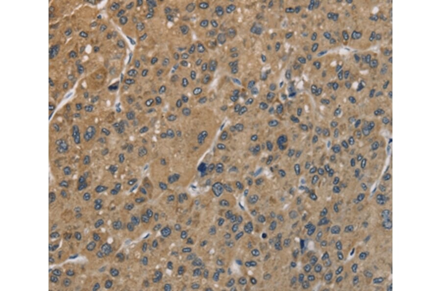 Immunohistochemistry - CENPN Antibody from Signalway Antibody (36342) - Antibodies.com