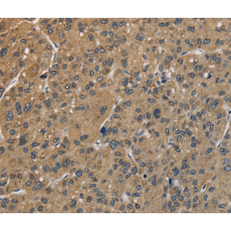 Immunohistochemistry - CENPN Antibody from Signalway Antibody (36342) - Antibodies.com