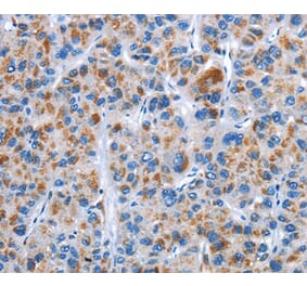 Immunohistochemistry - CENPJ Antibody from Signalway Antibody (36343) - Antibodies.com