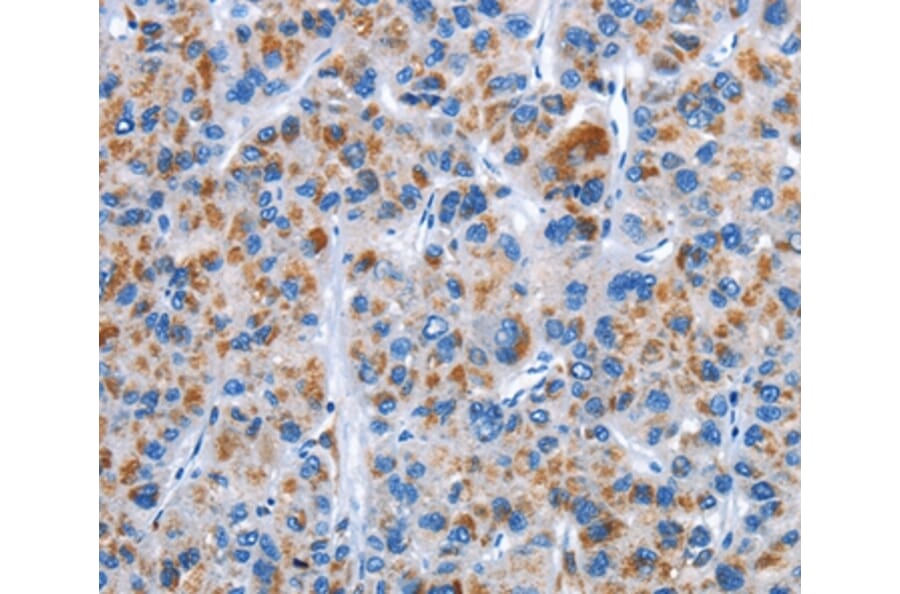 Immunohistochemistry - CENPJ Antibody from Signalway Antibody (36343) - Antibodies.com