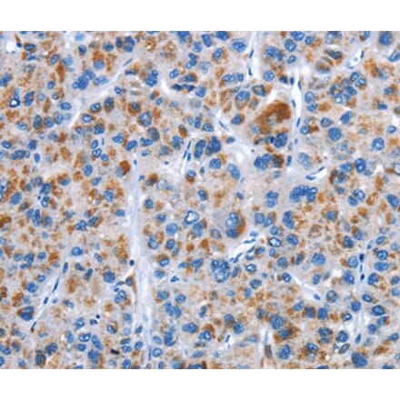 Immunohistochemistry - CENPJ Antibody from Signalway Antibody (36343) - Antibodies.com