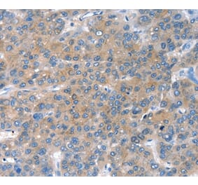 Immunohistochemistry - CHAC1 Antibody from Signalway Antibody (36347) - Antibodies.com