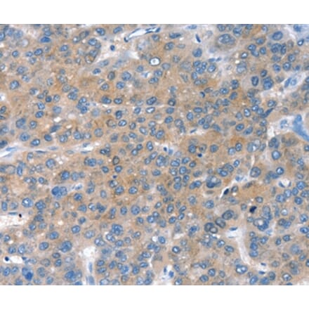 Immunohistochemistry - CHAC1 Antibody from Signalway Antibody (36347) - Antibodies.com