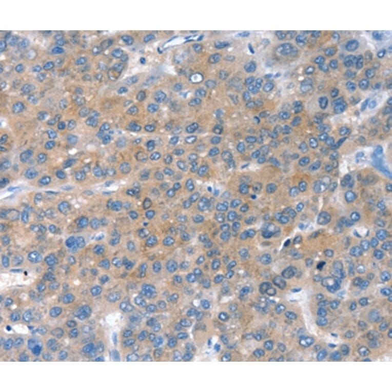 Immunohistochemistry - CHAC1 Antibody from Signalway Antibody (36347) - Antibodies.com