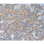 Immunohistochemistry - CHAC1 Antibody from Signalway Antibody (36347) - Antibodies.com