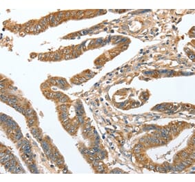Immunohistochemistry - CKAP2 Antibody from Signalway Antibody (36355) - Antibodies.com