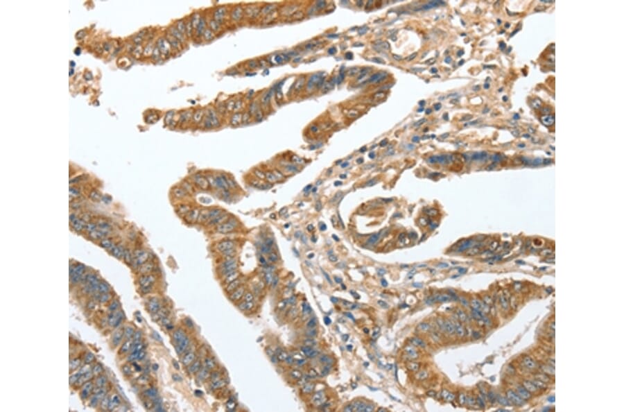 Immunohistochemistry - CKAP2 Antibody from Signalway Antibody (36355) - Antibodies.com