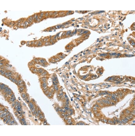 Immunohistochemistry - CKAP2 Antibody from Signalway Antibody (36355) - Antibodies.com