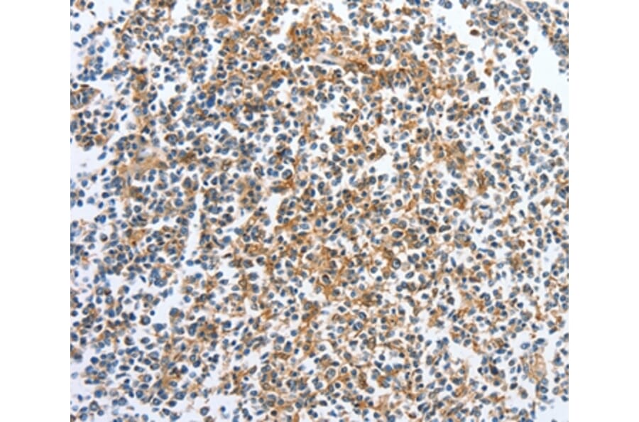 Immunohistochemistry - CKAP2 Antibody from Signalway Antibody (36355) - Antibodies.com