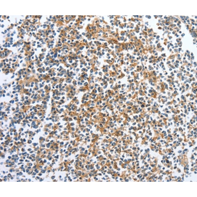 Immunohistochemistry - CKAP2 Antibody from Signalway Antibody (36355) - Antibodies.com
