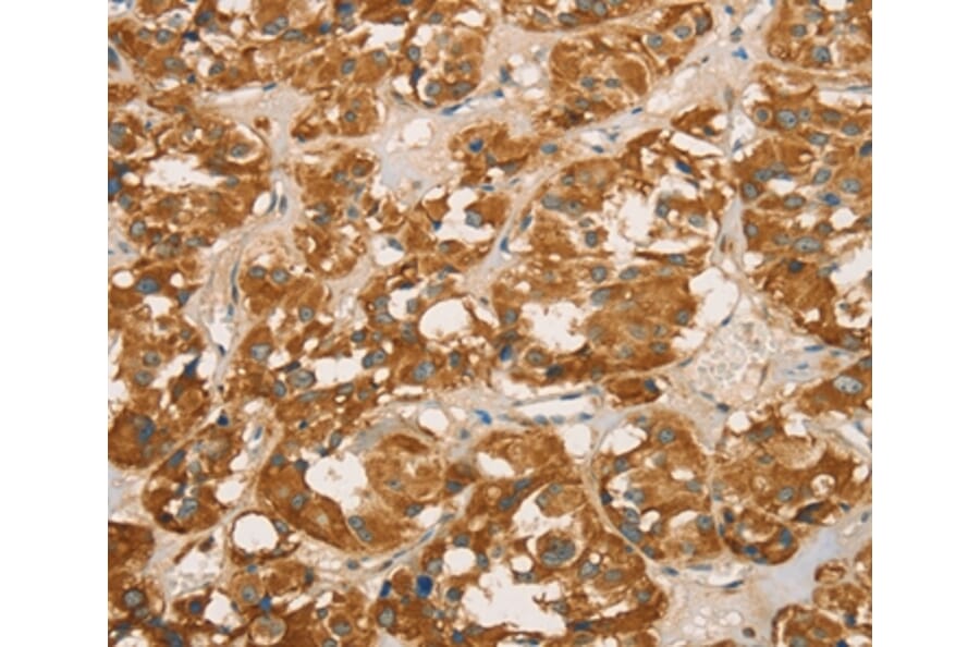 Immunohistochemistry - RBBP8 Antibody from Signalway Antibody (36376) - Antibodies.com